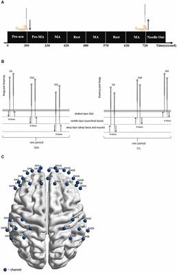 Methodological issues of the central mechanism of two classic acupuncture manipulations based on fNIRS: suggestions for a pilot study